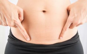 Qeysəriyyə kəsiyi